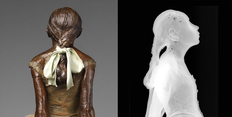 On the left, the Little Dancer seen from the back, her braid tied with a satin bow; on the right, a black-and-white x-ray profile view