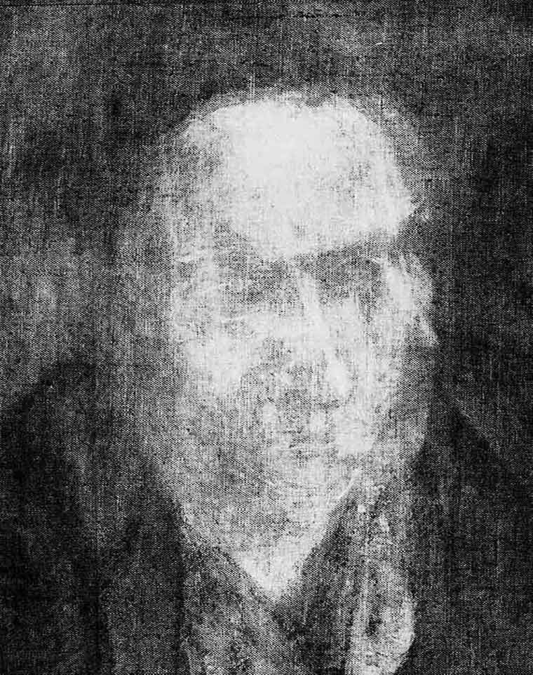 Black-and-white radiograph showing various early stages of Gertrude Stein's face